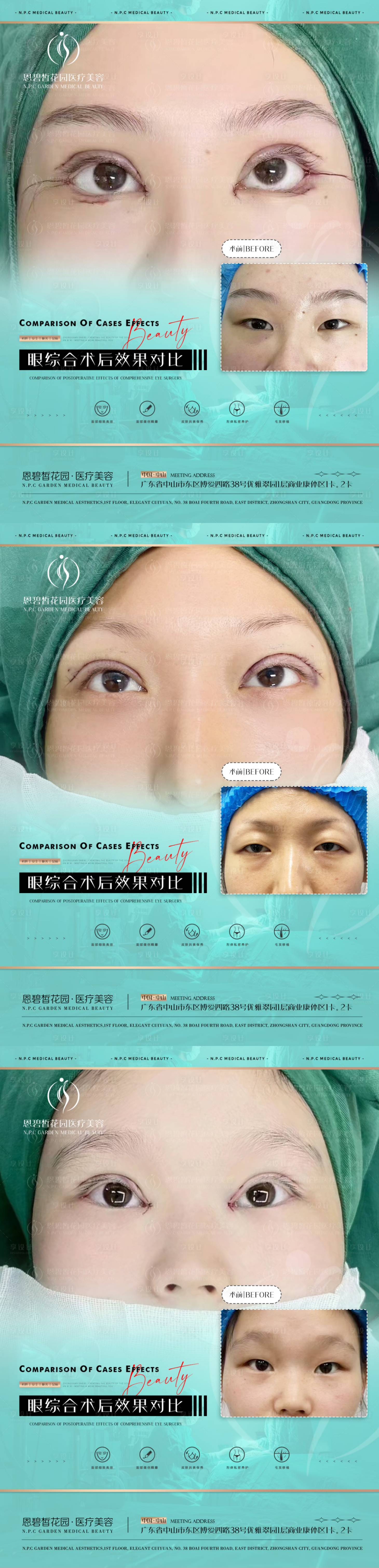 源文件下载【享设计】搜索编号：57300020998533641【医美整形双眼皮眼综合项目系列海报】