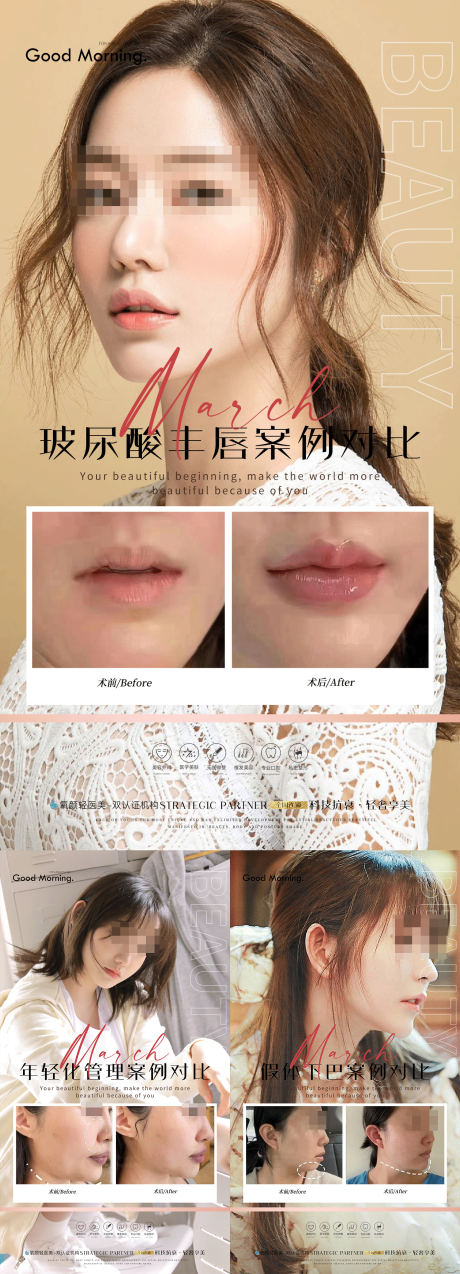 源文件下載【享設計】搜索編號：95400021014679515【整形案例海報】