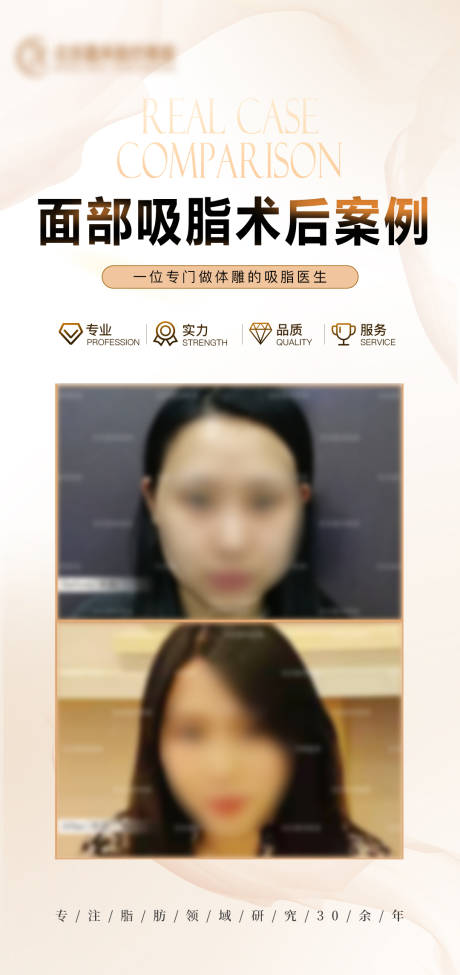 源文件下载【面部吸脂案例医美海报】编号：73400020624854785