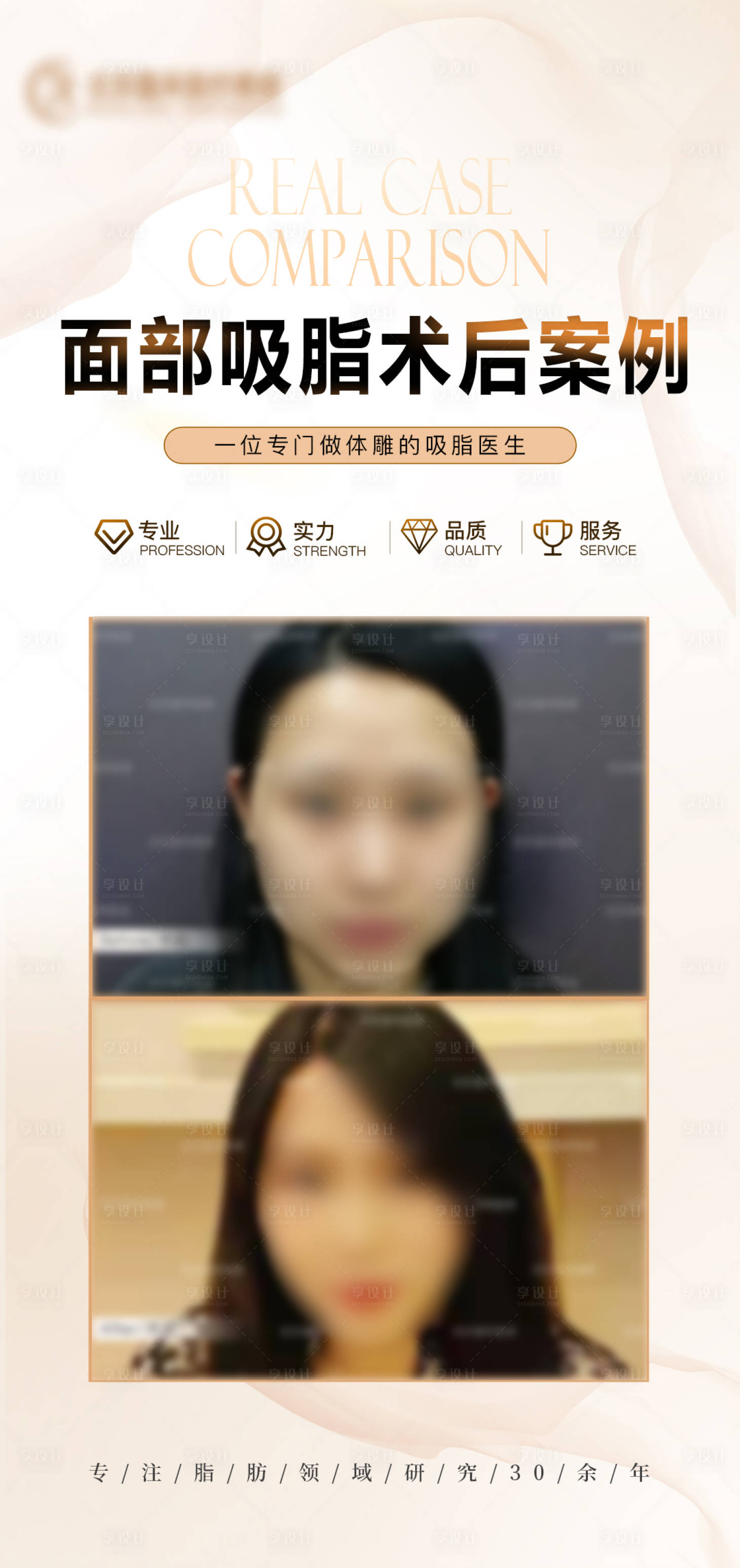 源文件下载【享设计】搜索编号：73400020624854785【面部吸脂案例医美海报】