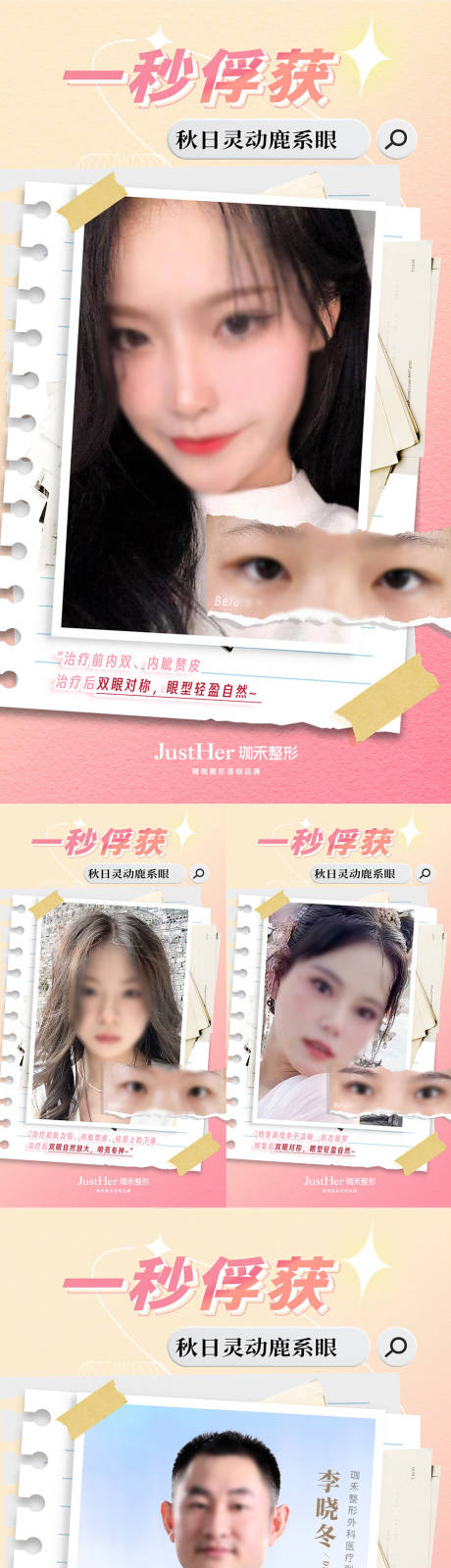 源文件下载【双眼皮案例对比海报】编号：23780020992803044