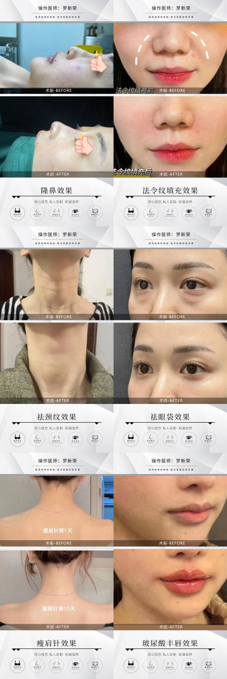 源文件下载【整形美容案例海报】编号：40410021045559143