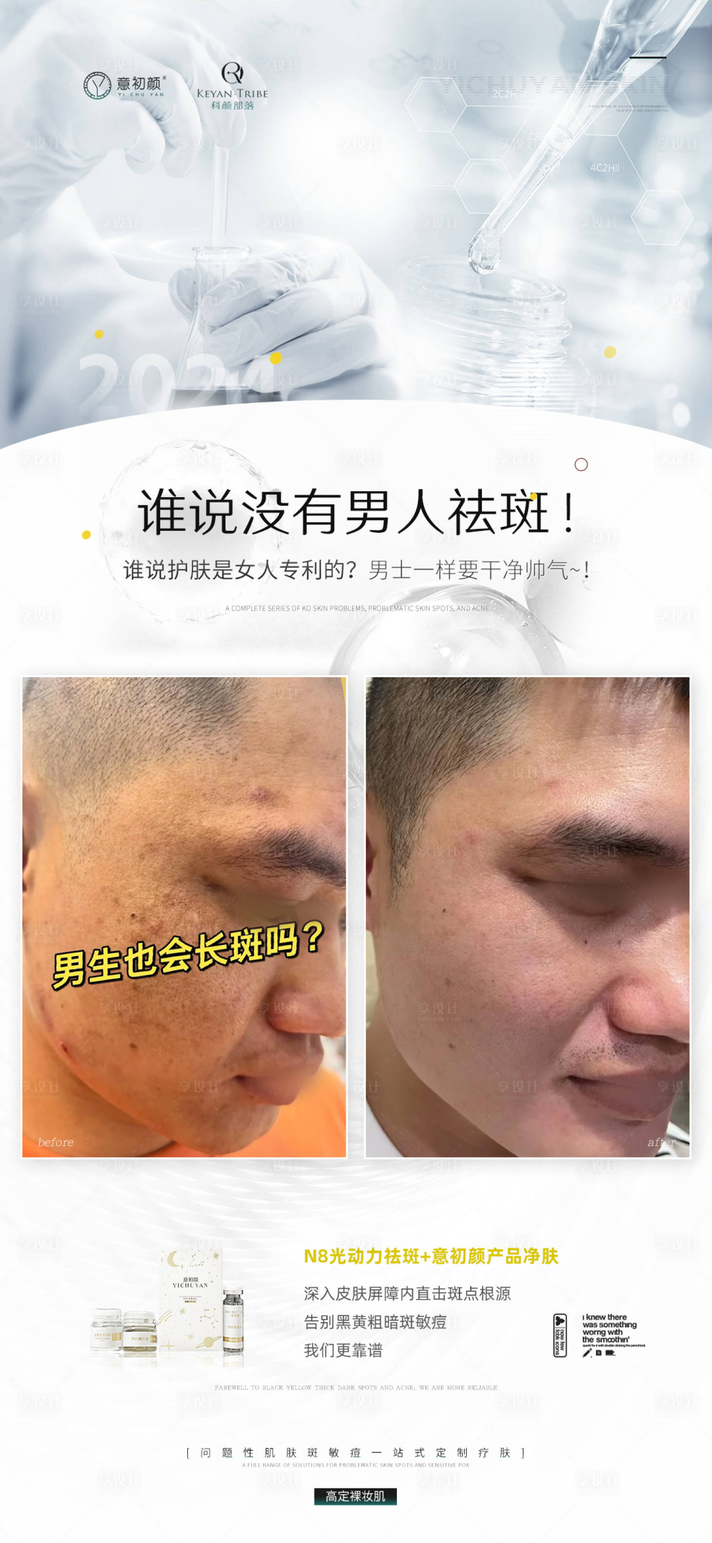 源文件下載【享設(shè)計(jì)】搜索編號：75770021082957482【長沙醫(yī)美美容祛斑美白痘痘模特對比海報(bào)】