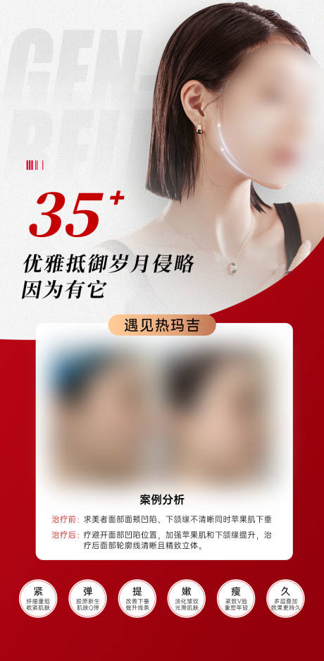 源文件下载【医美热玛吉海报】编号：64250021177619709