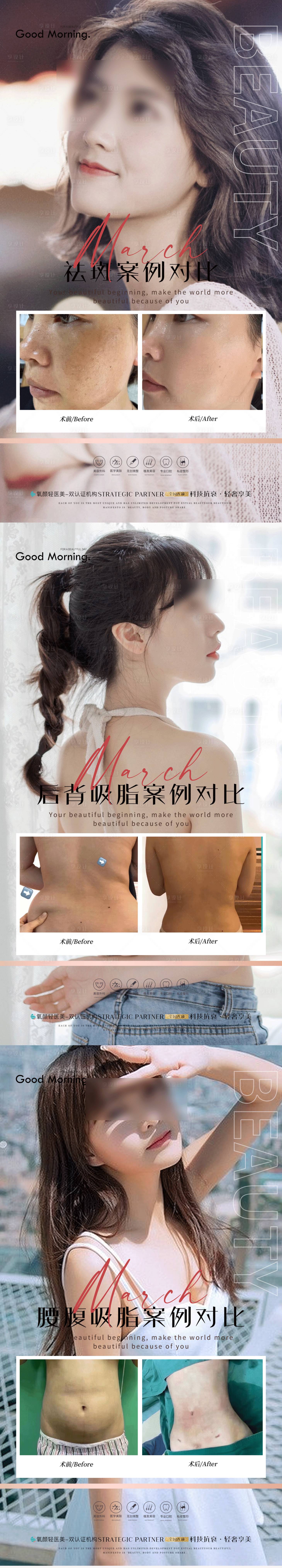 源文件下載【享設(shè)計(jì)】搜索編號(hào)：99730020718003720【美容整形案例】