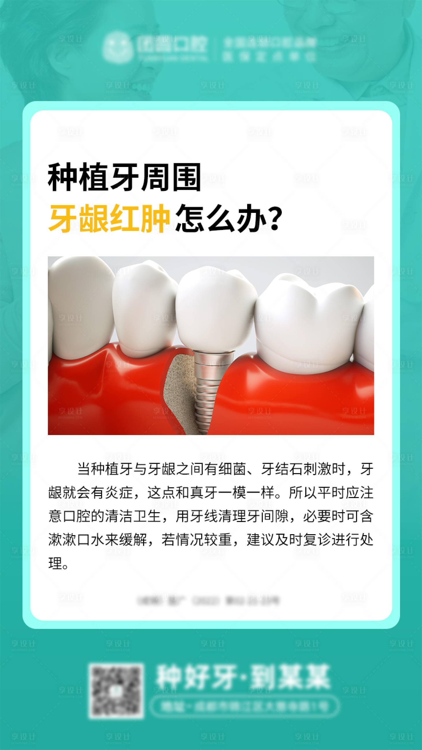 源文件下载【享设计】搜索编号：49880020728131767【口腔医院种植牙科普】