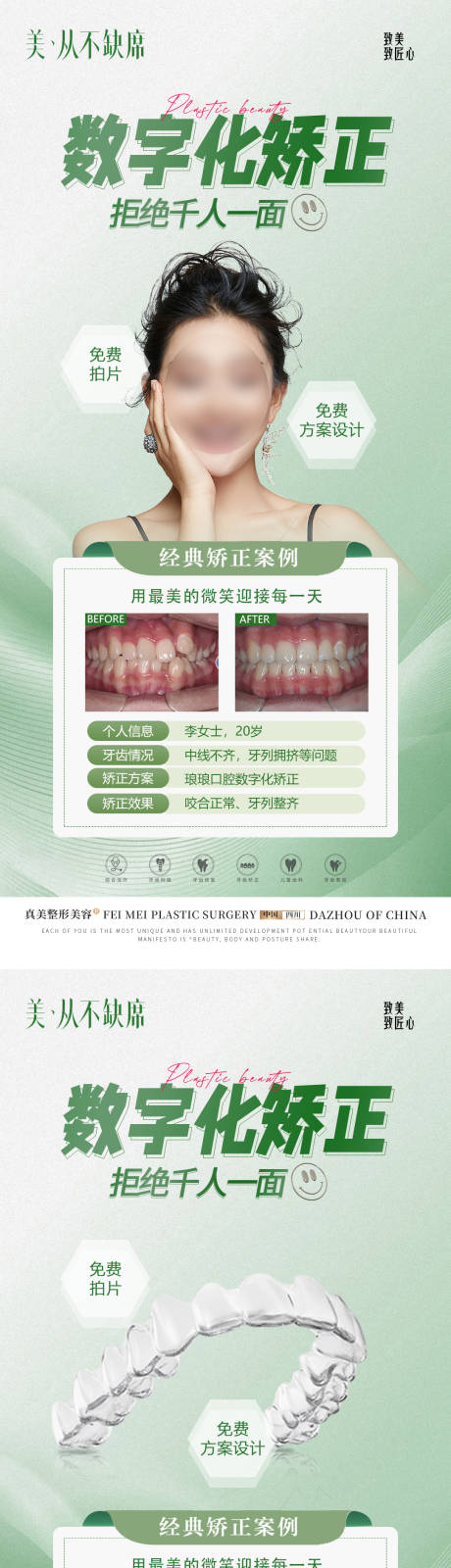 源文件下载【口腔数字化矫正案例海报】编号：20231221144941307