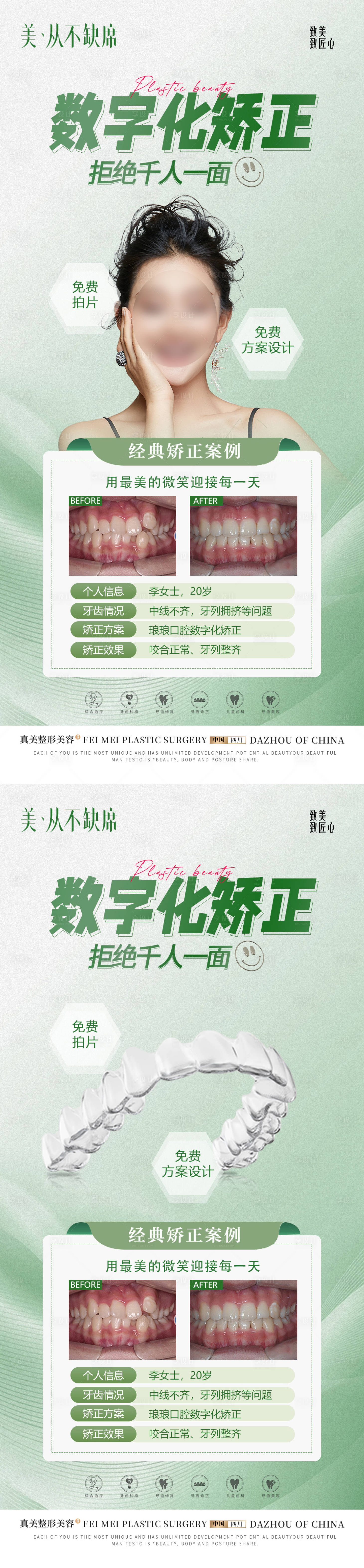源文件下载【口腔数字化矫正案例海报】编号：95360021090466855