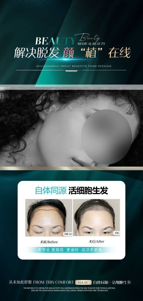 源文件下載【享設計】搜索編號：63090020825826299【植發海報】