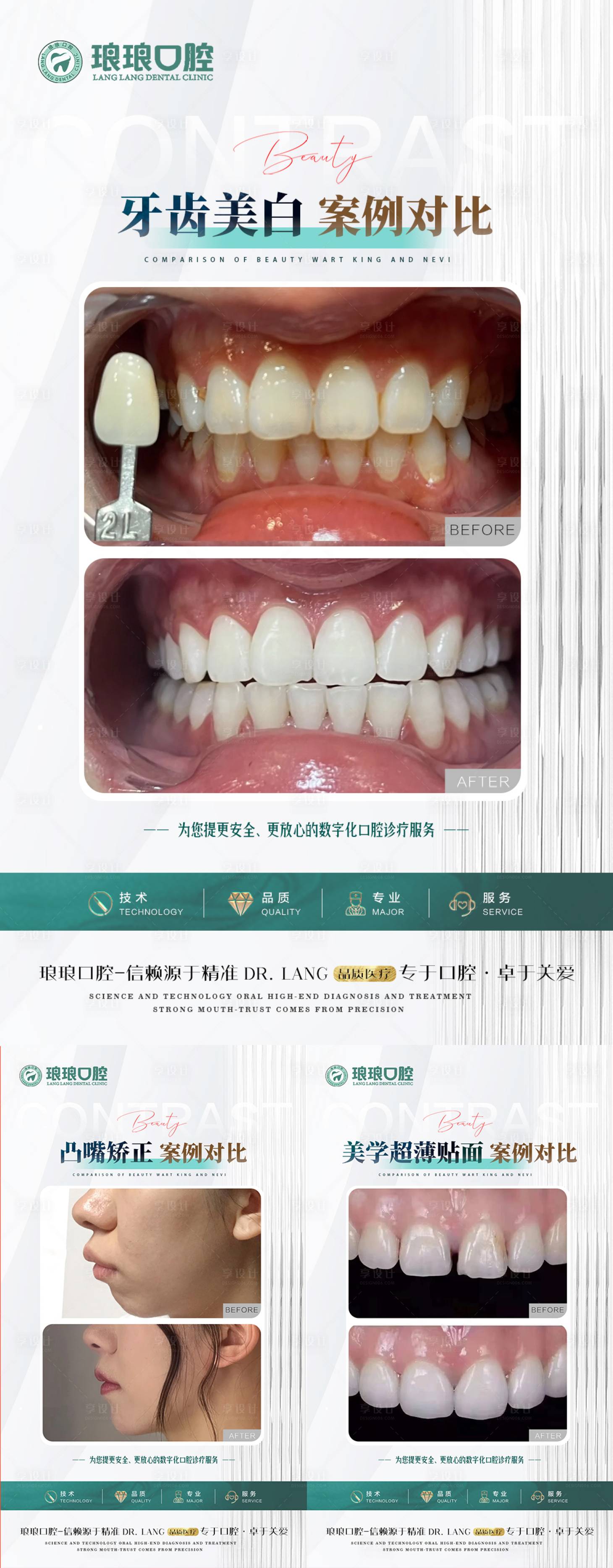 源文件下载【享设计】搜索编号：31720021122293943【口腔牙齿简约案例海报】