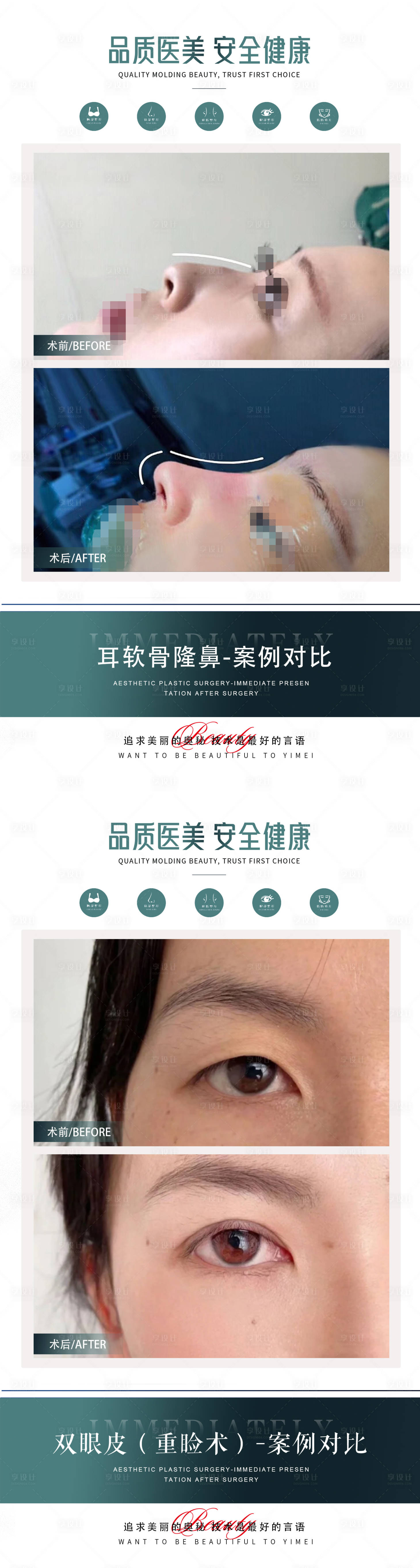源文件下载【享设计】搜索编号：67090021191533298【医美隆鼻双眼皮案例海报】
