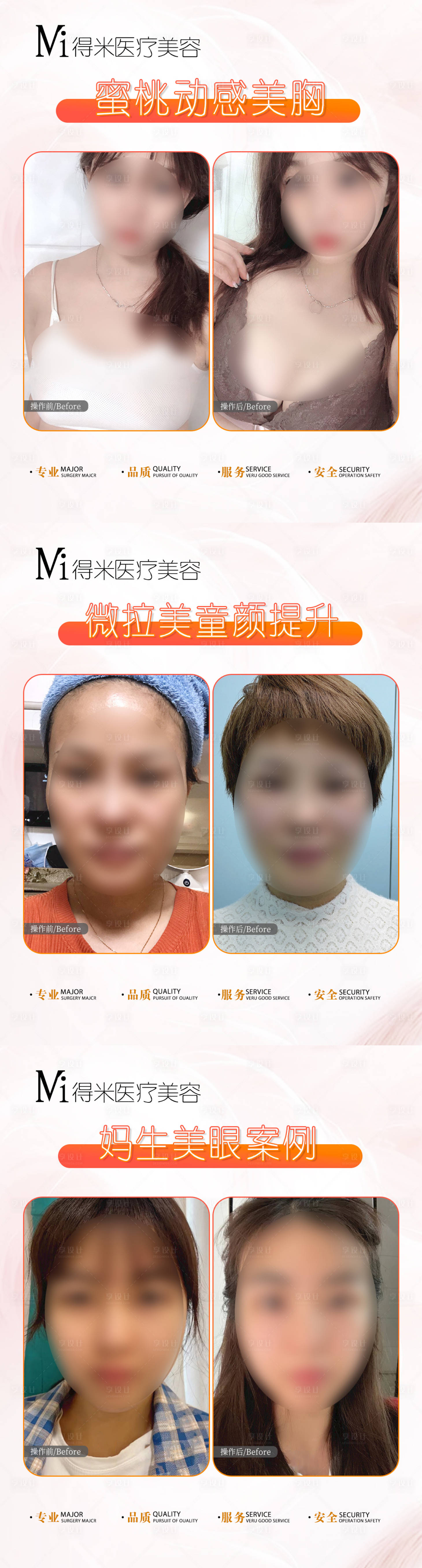 源文件下載【享設計】搜索編號：99130020840567734【醫美整形案例對比海報】