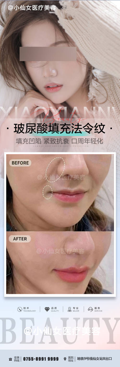 源文件下载【整形美容案例海报】编号：59750021253374708