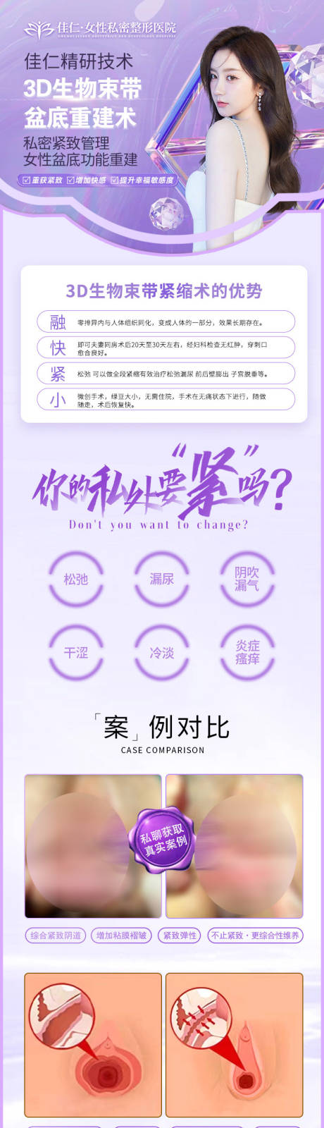源文件下載【享設(shè)計】搜索編號：40230020841539324【醫(yī)美私密海報】