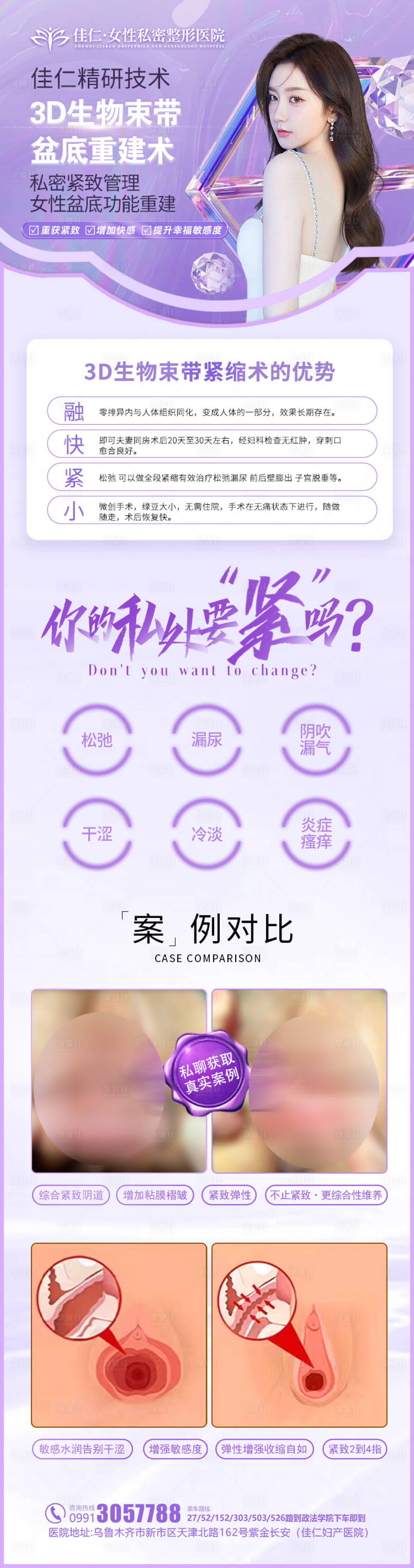 源文件下載【享設(shè)計】搜索編號：40230020841539324【醫(yī)美私密海報】