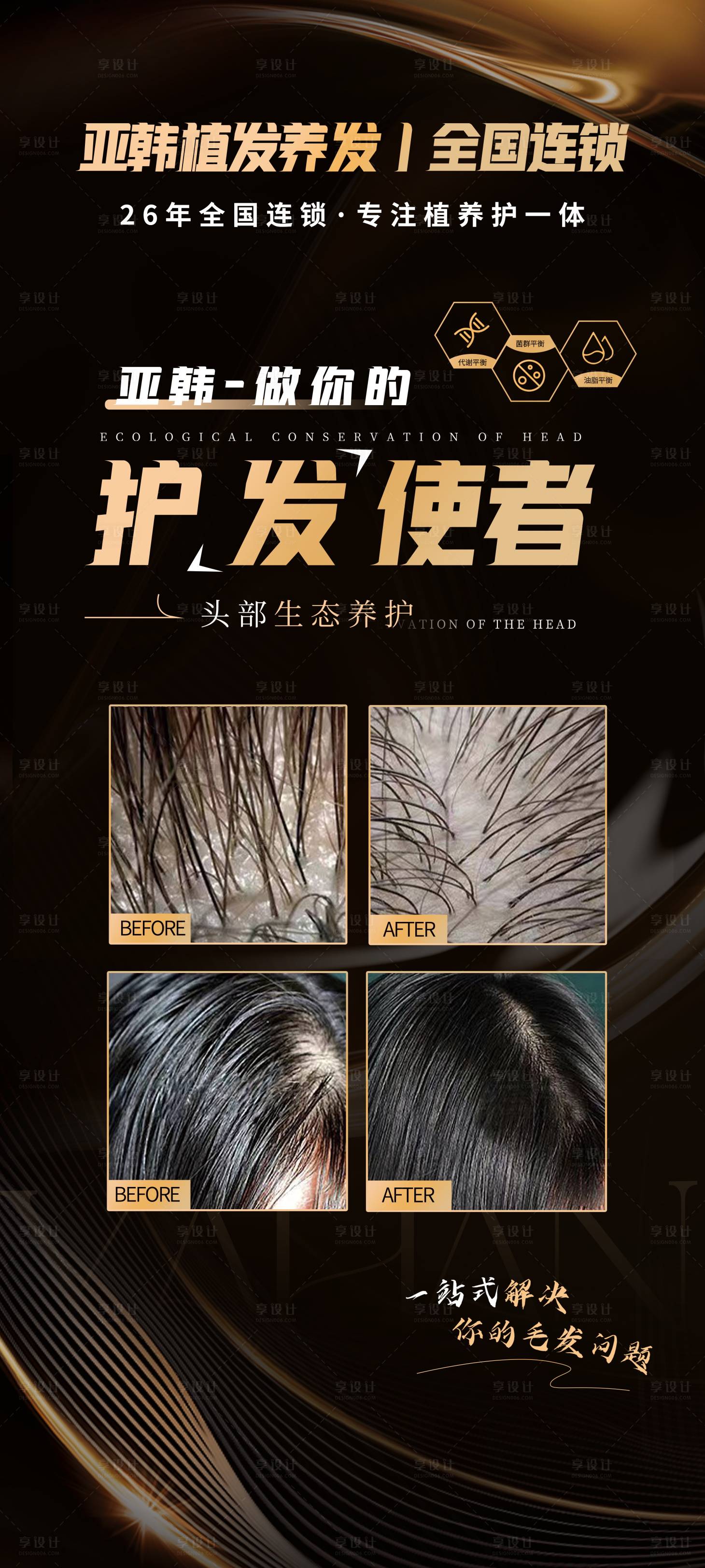 源文件下載【享設計】搜索編號：12610020996213697【黑金醫美植發海報】