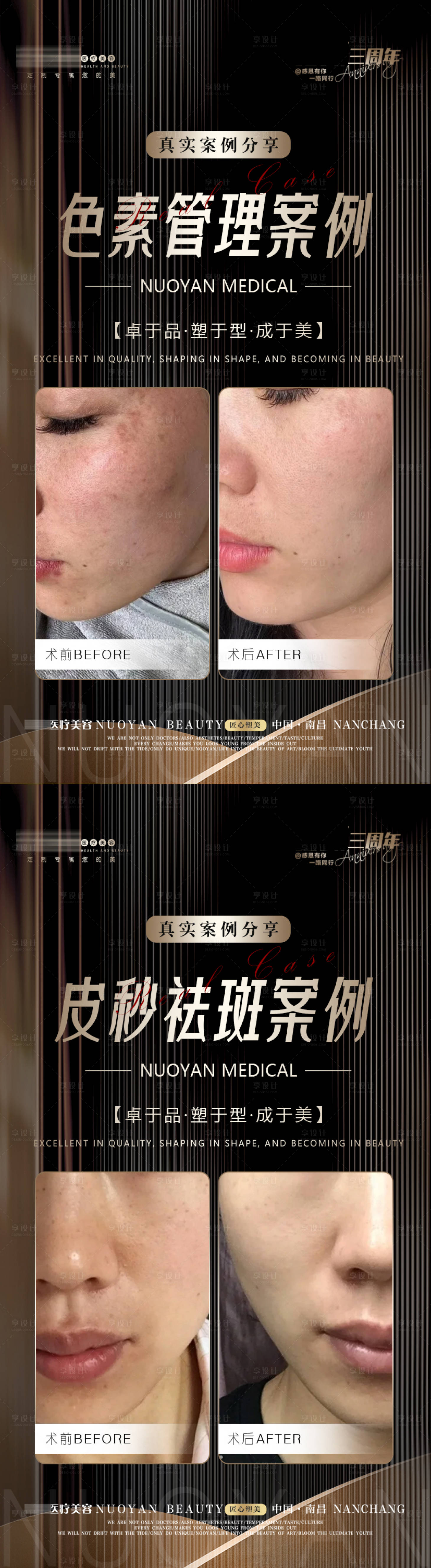 源文件下载【医美黑金案例海报】编号：34950021207729477