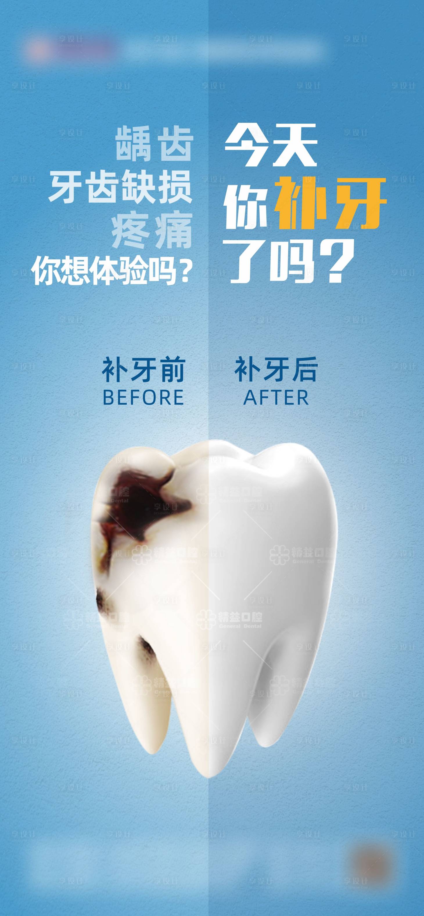 源文件下載【補(bǔ)牙齲齒宣傳海報(bào)】編號(hào)：60420020876791865