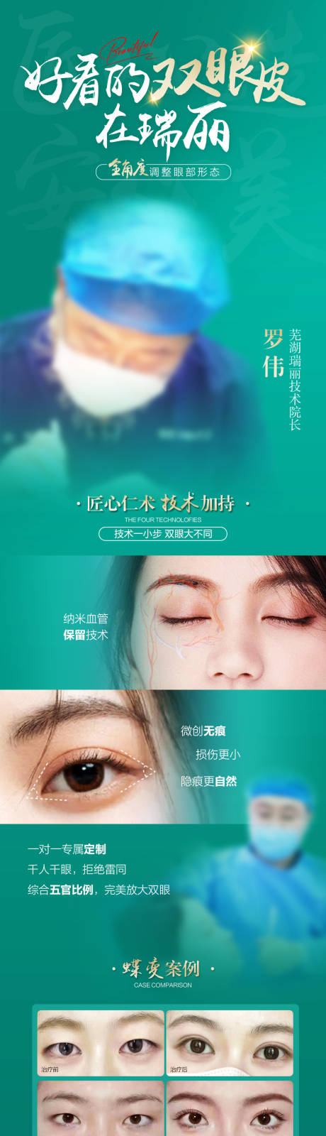 源文件下载【双眼皮海报】编号：44580021236727971