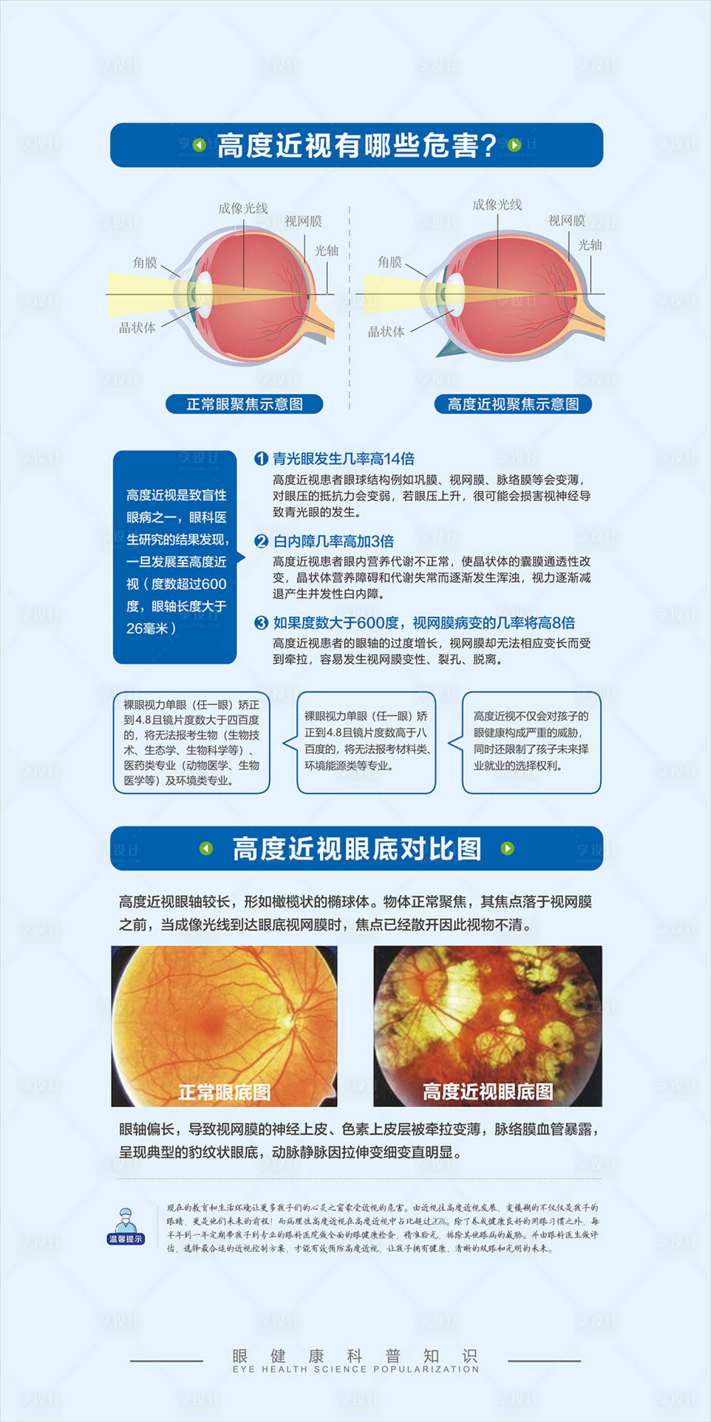 源文件下载【享设计】搜索编号：53820021064605623【眼健康科普海报】