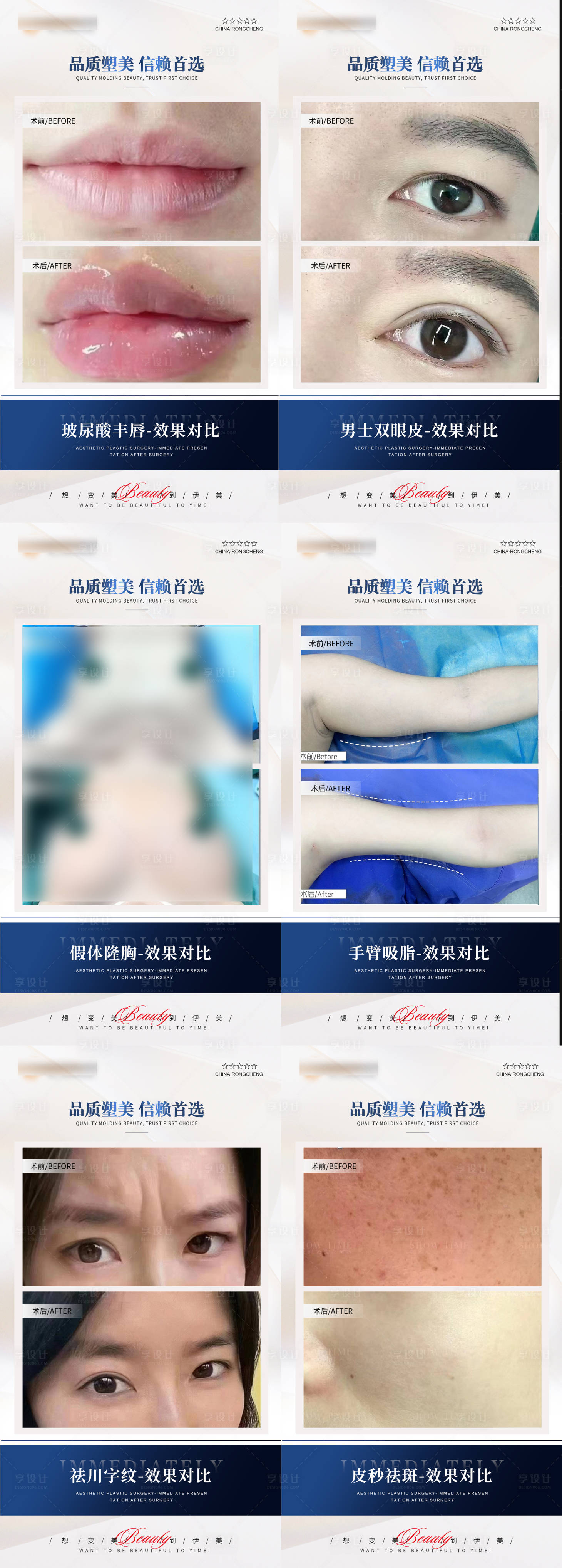 源文件下载【整形案例】编号：40650021157295268