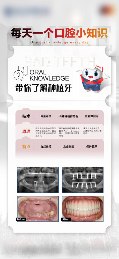 源文件下载【医美口腔种植牙科普海报】编号：72920020756965733