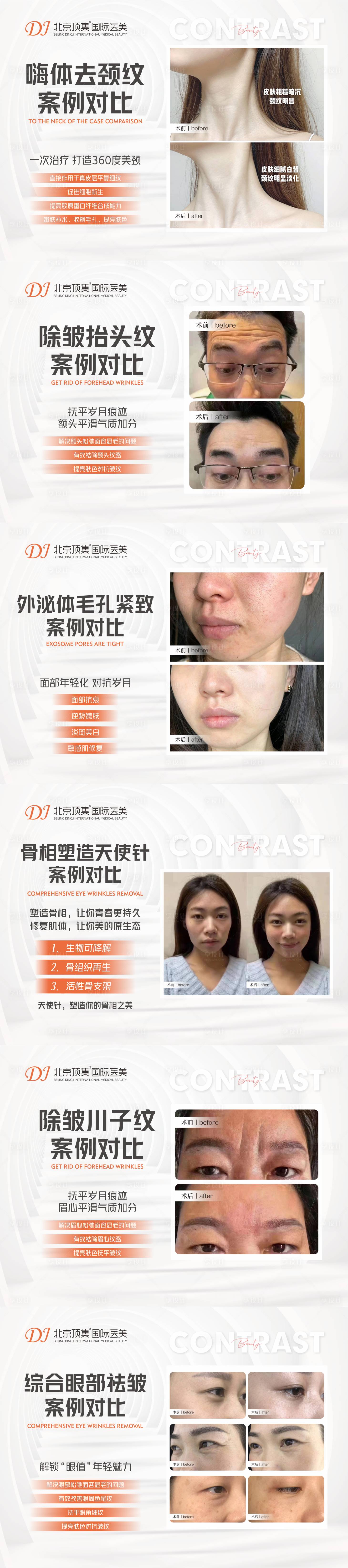 源文件下載【享設計】搜索編號：97040021363004483【醫美項目案例對比banner】