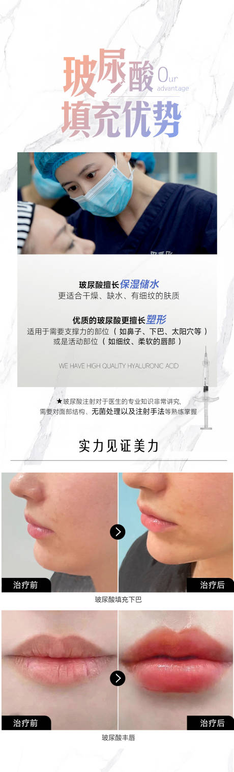 源文件下载【医美玻尿酸填充海报】编号：16540021519353749