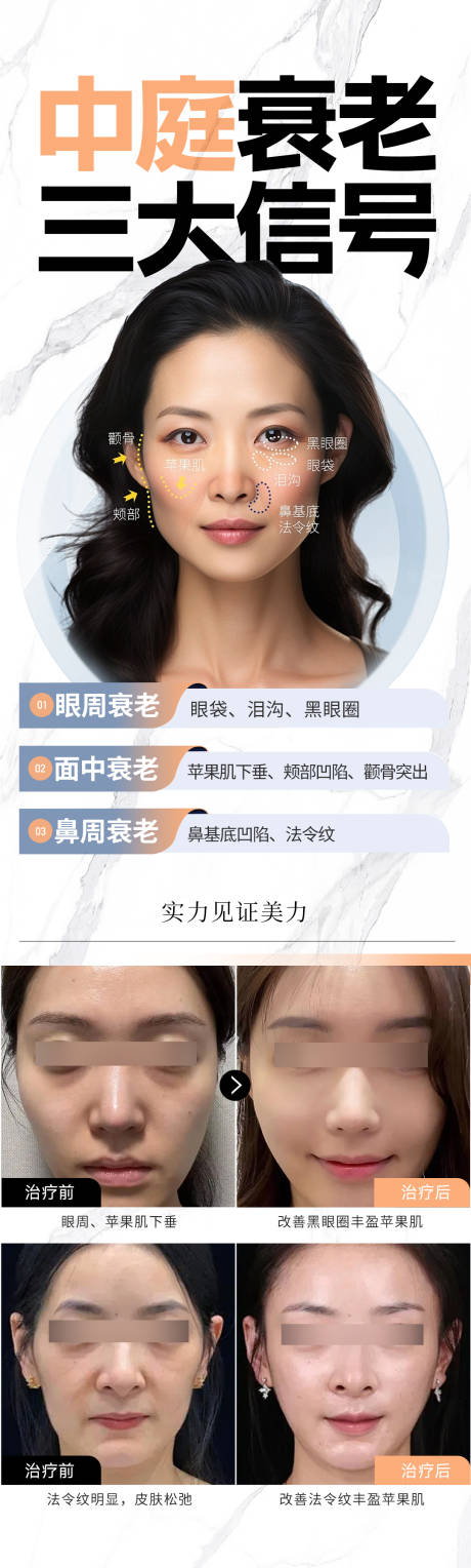 源文件下載【享設計】搜索編號：35840021582395508【醫(yī)美抗衰海報】