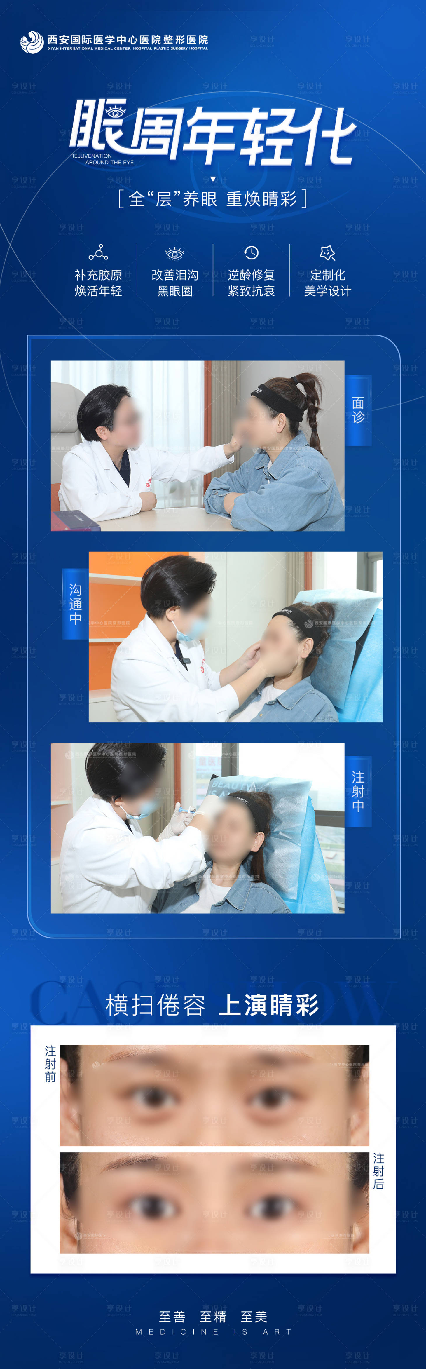 源文件下载【享设计】搜索编号：77650021337477076【医美眼周年轻化案例日记医生面诊海报】