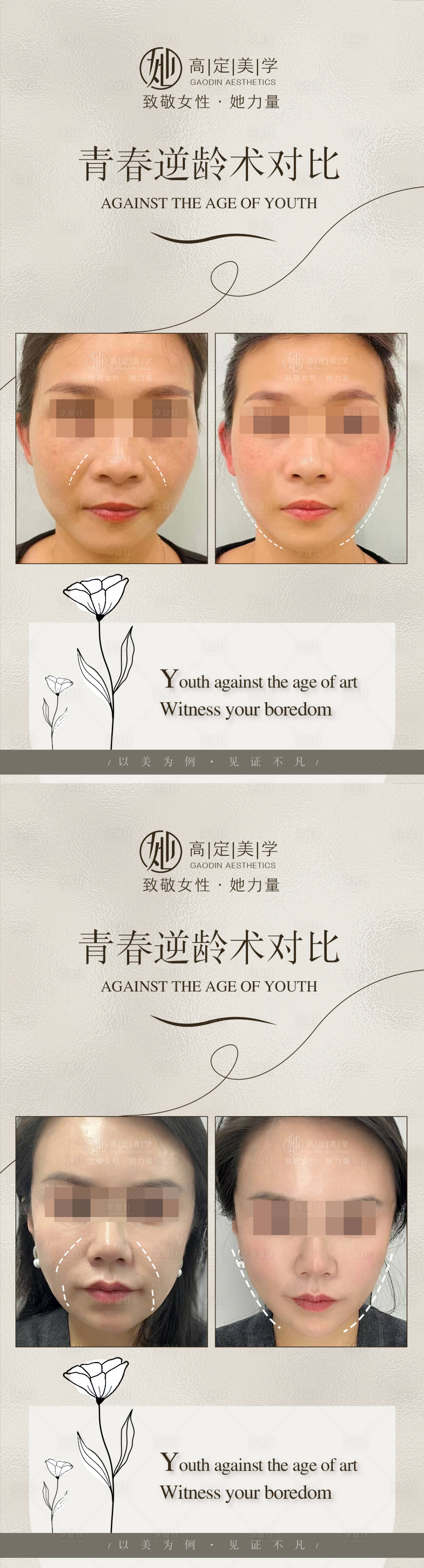 源文件下载【享设计】搜索编号：46190021731772579【医美美业案例对比海报】