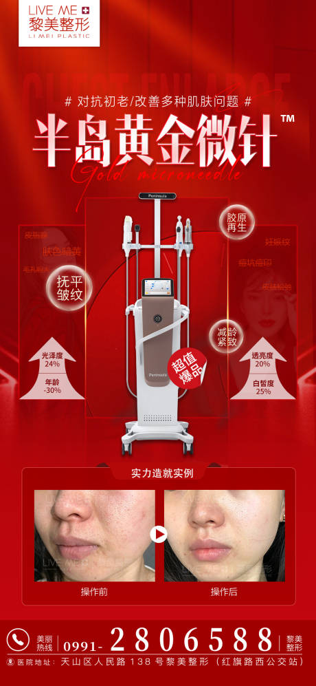 源文件下載【半島黃金微針】編號：70790021798832690