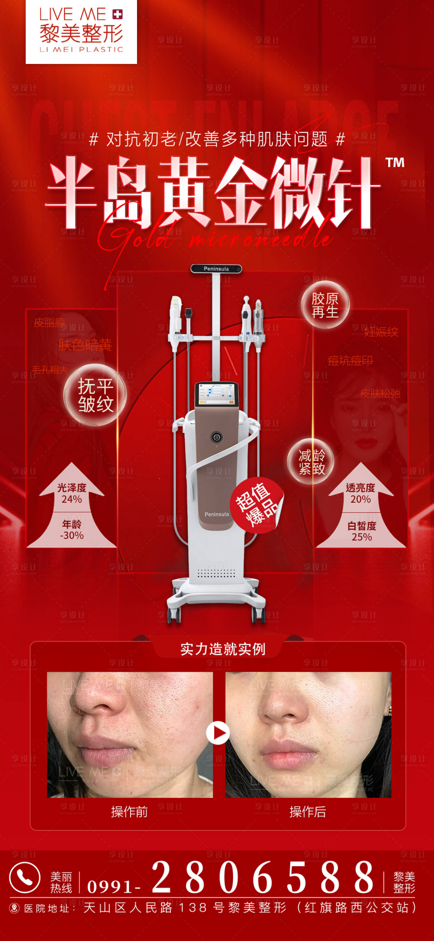源文件下载【享设计】搜索编号：70790021798832690【半岛黄金微针】