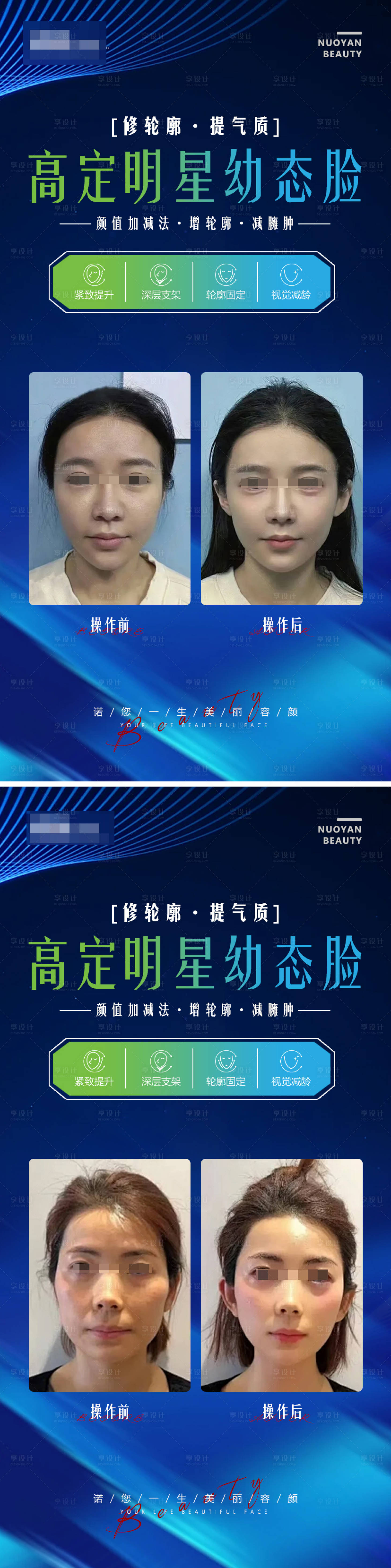 源文件下載【享設(shè)計】搜索編號：74000021547741215【幼態(tài)臉案例海報】