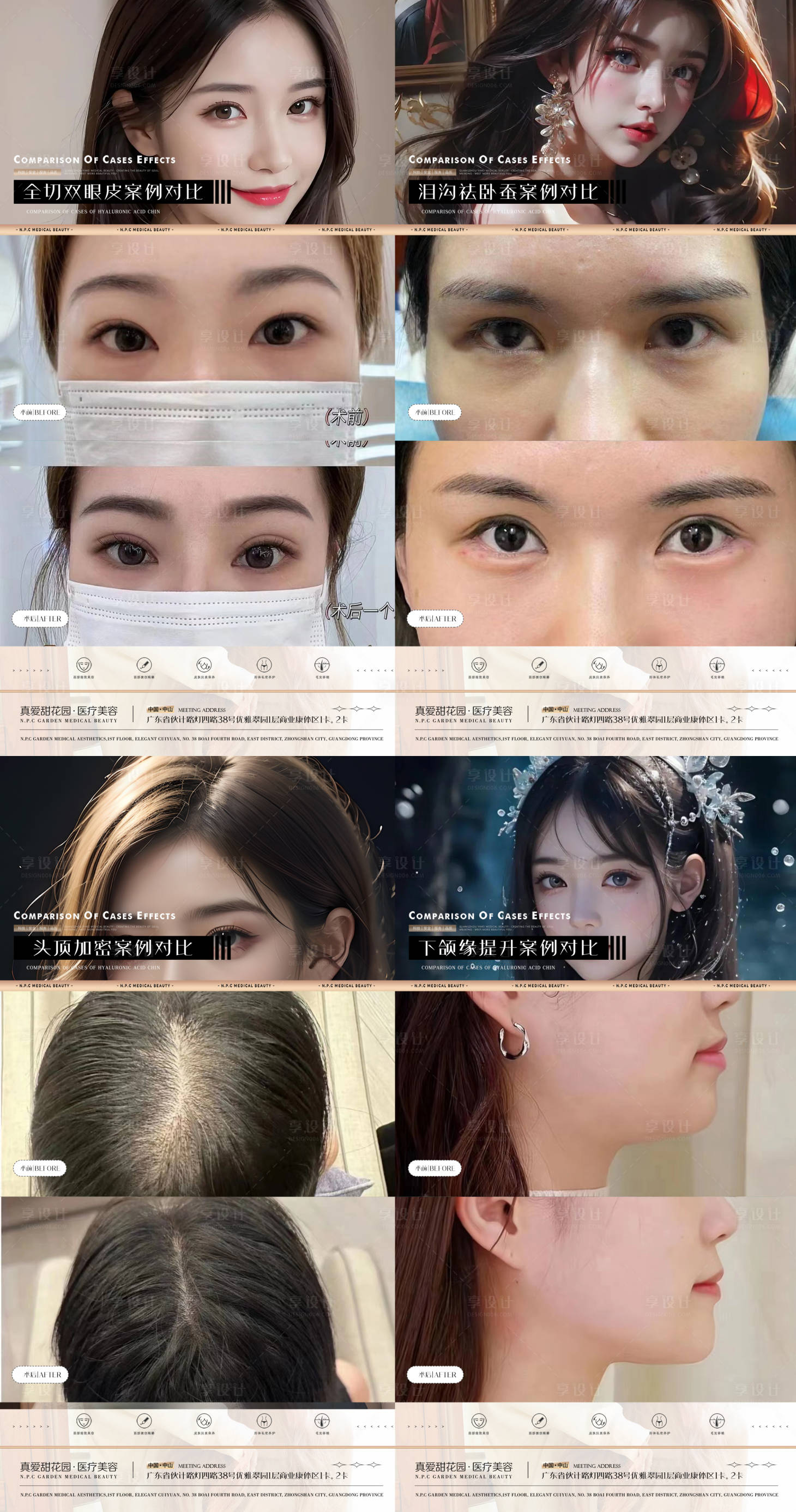 源文件下载【美容案例海报】编号：67490021547385143