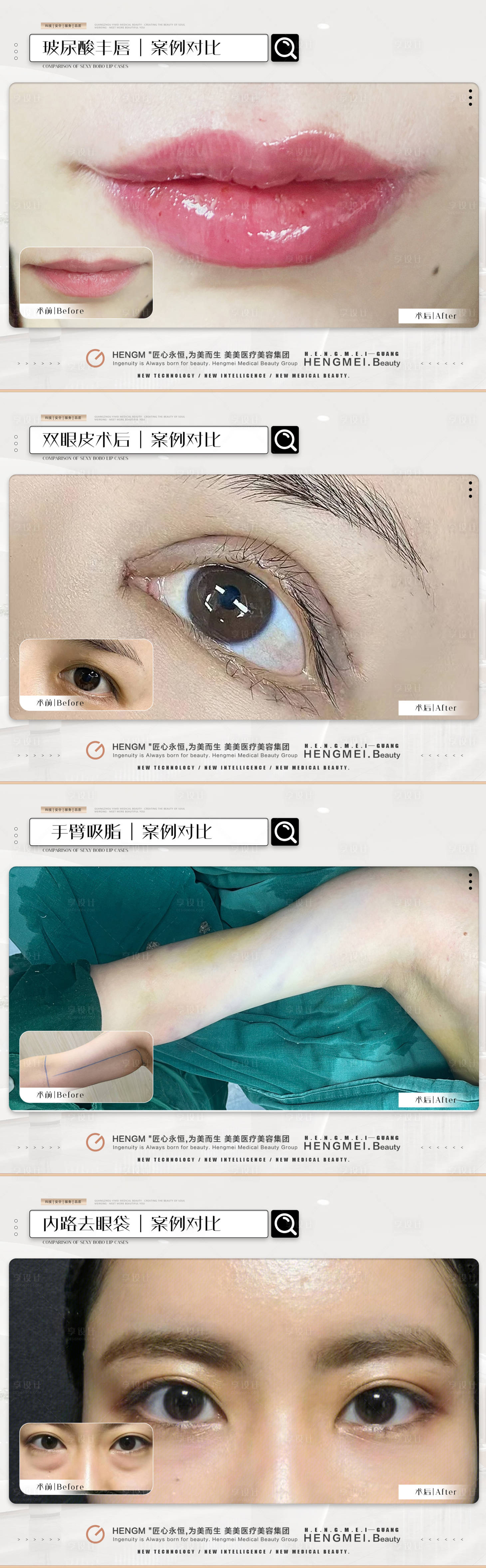 源文件下载【享设计】搜索编号：96760021732048527【整形美容案例】