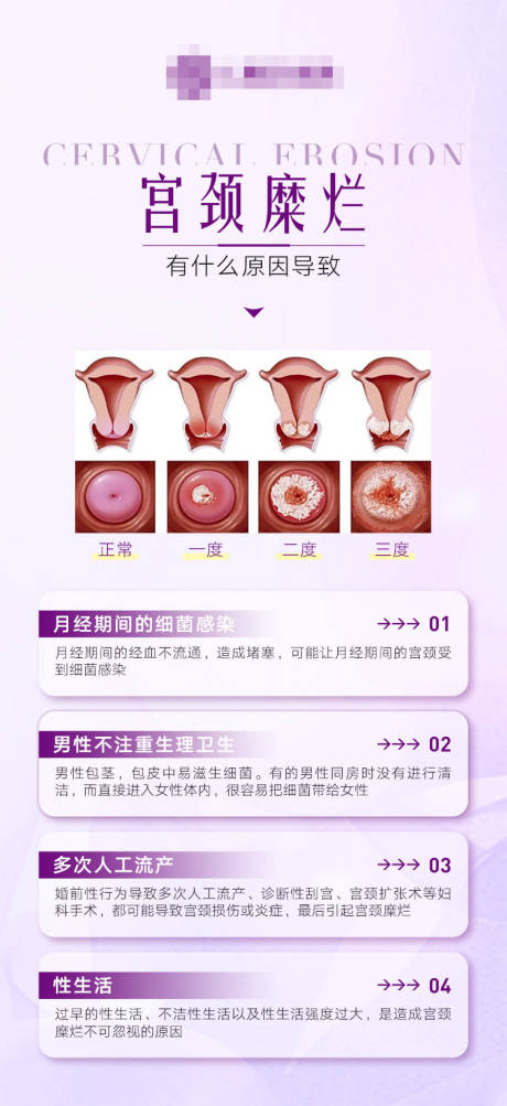 源文件下载【妇科海报】编号：87840021527107206