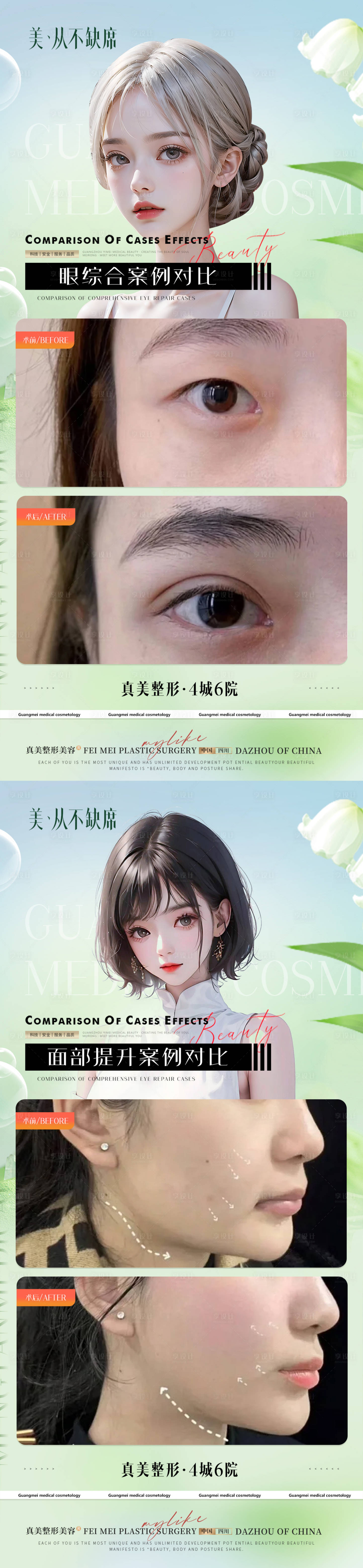 源文件下载【享设计】搜索编号：64260021685304966【医美模特案例海报】