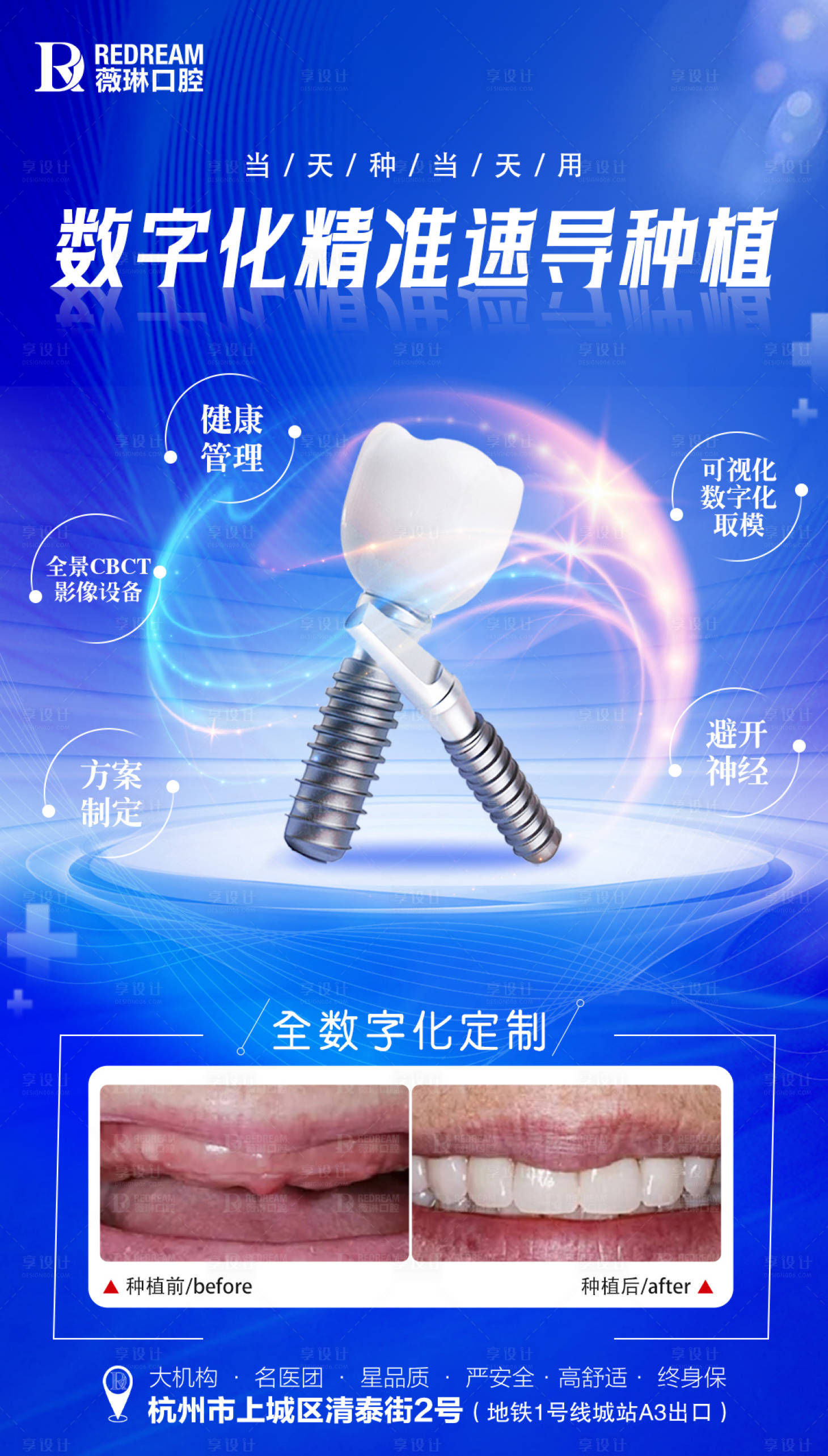 源文件下载【享设计】搜索编号：66430021688383017【口腔种植】