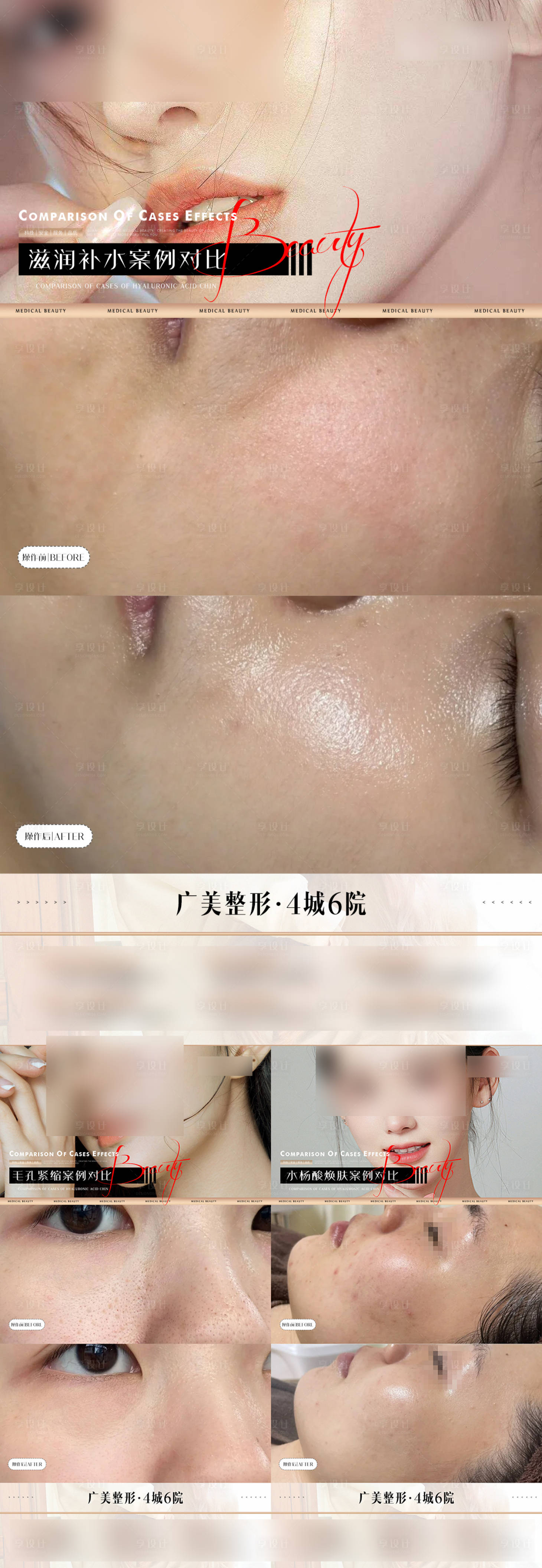 源文件下载【医美简约案例对比海报】编号：76830021807413646
