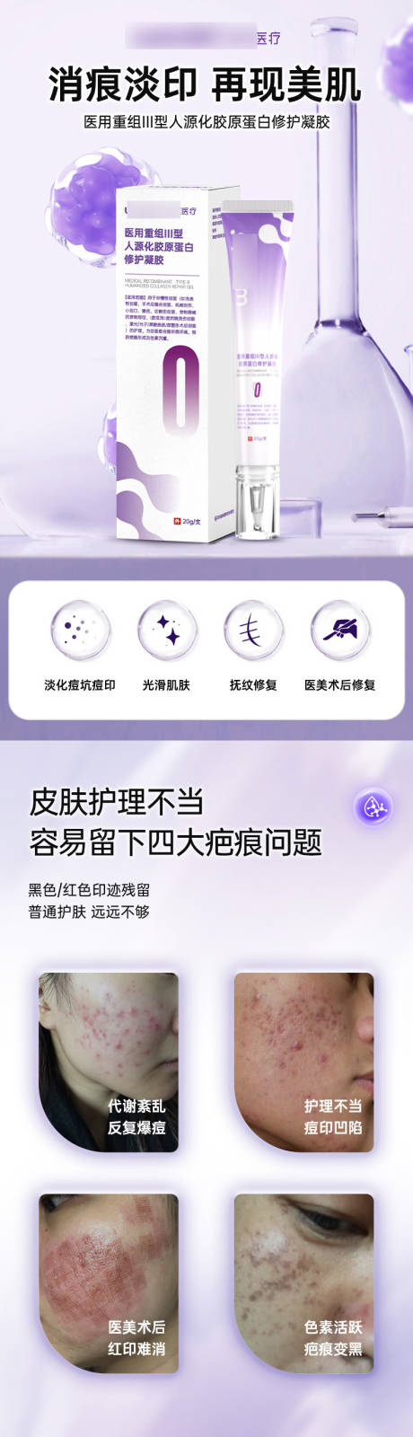 源文件下載【享設(shè)計】搜索編號：73470021293425198【醫(yī)用硅酮疤痕凝膠詳情圖】