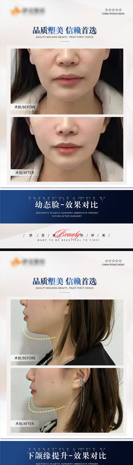 源文件下载【享设计】搜索编号：73350021792622115【医美海报】