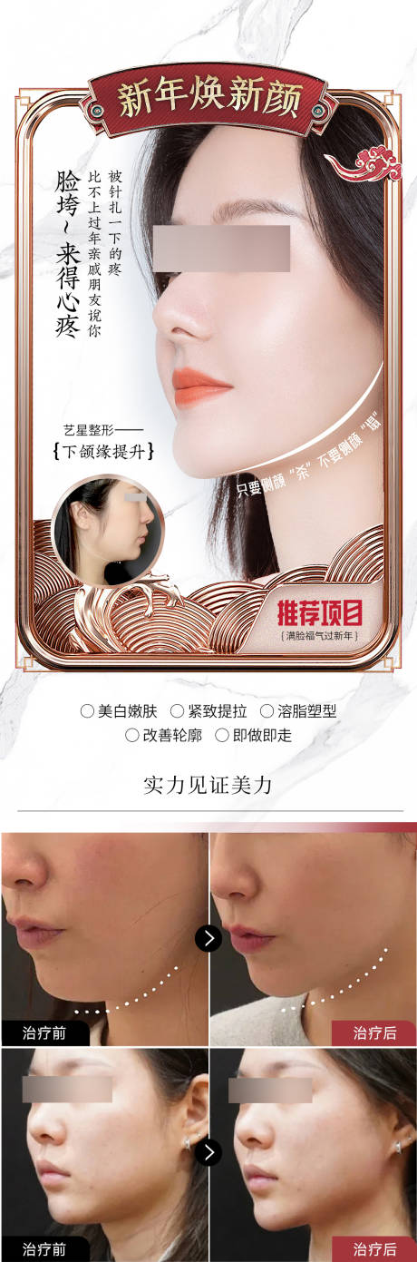 源文件下载【享设计】搜索编号：68010021841267843【医美下颌缘海报】