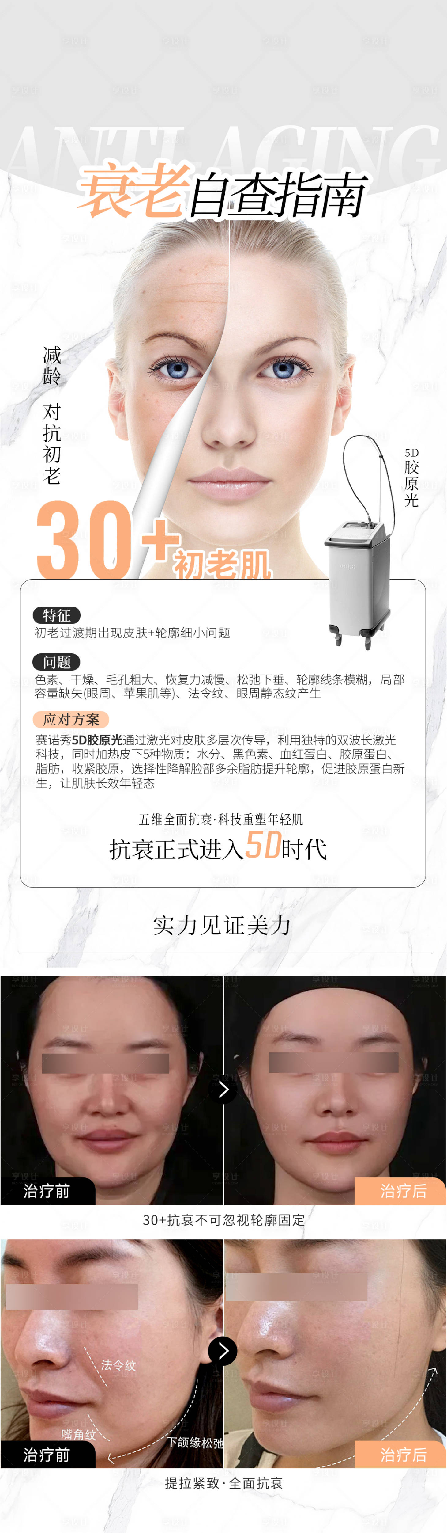 源文件下載【享設(shè)計】搜索編號：34130021662218926【醫(yī)美5D膠原光科普宣傳海報】
