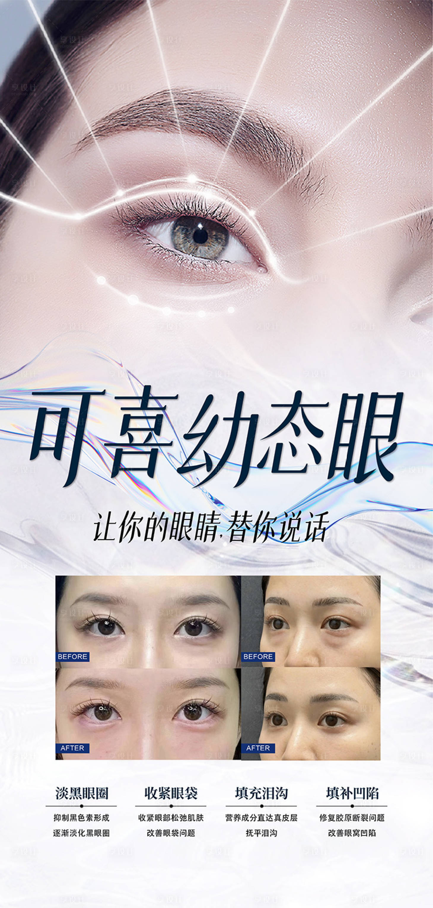 源文件下载【可喜幼态眼海报】编号：76190021406823621