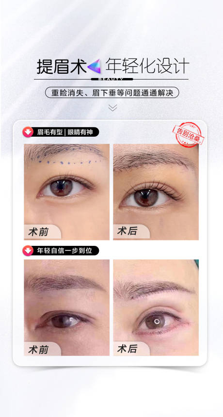 源文件下载【提眉案例海报】编号：71310021385642498
