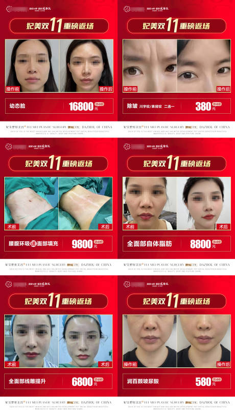 源文件下载【医美双11活动案例价格】编号：86770021548091598