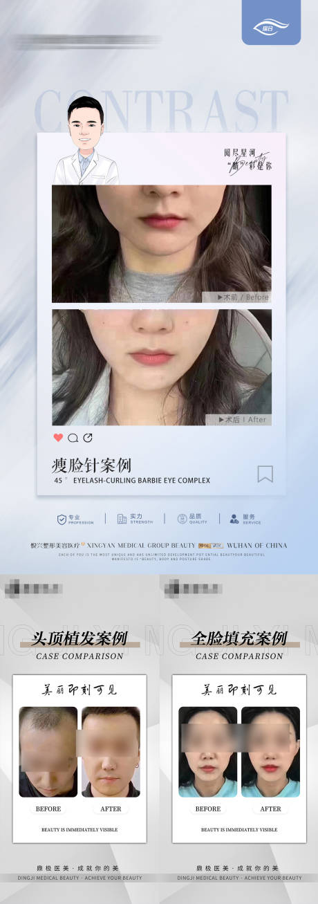 源文件下载【医美简约案例】编号：87150021405078538
