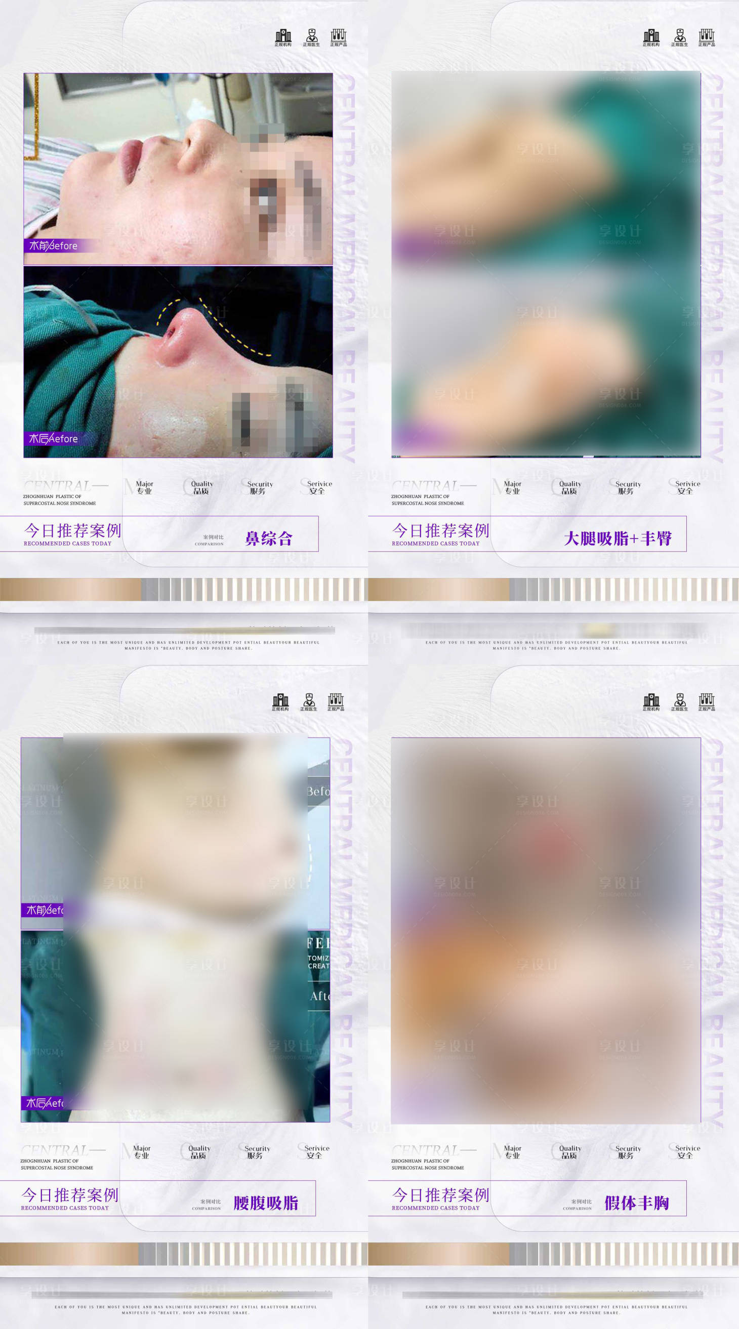 源文件下载【医美案例合集海报】编号：71650017690676757