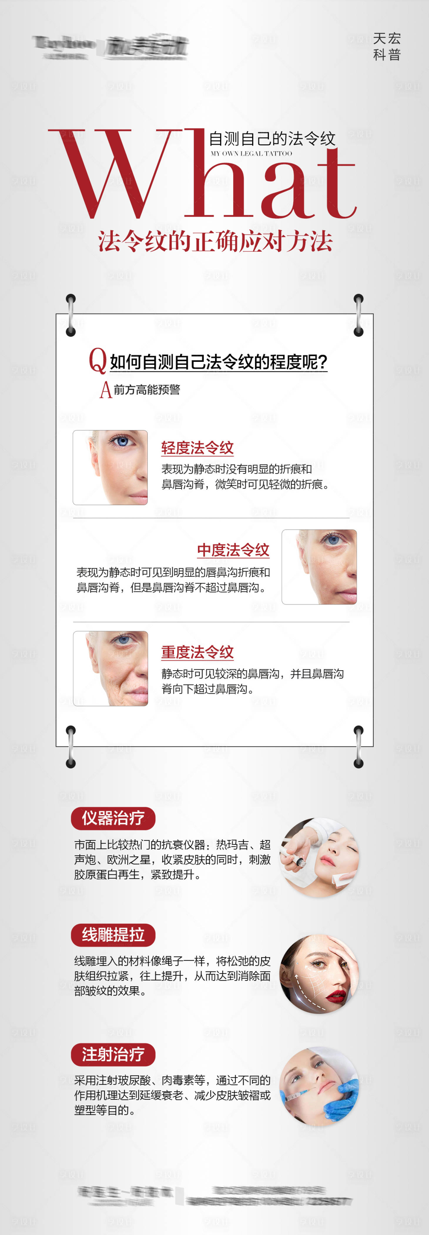 源文件下載【享設計】搜索編號：58180021282578316【醫(yī)美法令紋科普海報】